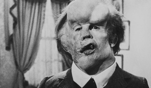 Cinegiornale.net the-elephant-man-in-arrivo-il-nuovo-film-basato-su-joseph-merrick-600x350 The Elephant Man: in arrivo il nuovo film basato su Joseph Merrick News  