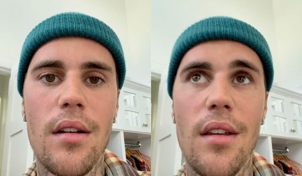 Cinegiornale.net sindrome-di-ramsey-hunt-ecco-cose-la-malattia-di-cui-soffre-justin-bieber-600x350 Sindrome di Ramsey Hunt: ecco cos’è la malattia di cui soffre Justin Bieber News  