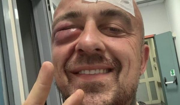 Cinegiornale.net il-famoso-chef-massacrato-irriconoscibile-volto-tumefatto-ma-nessuna-denuncia-600x350 Il famoso chef massacrato, irriconoscibile | Volto tumefatto ma nessuna denuncia Gossip News  