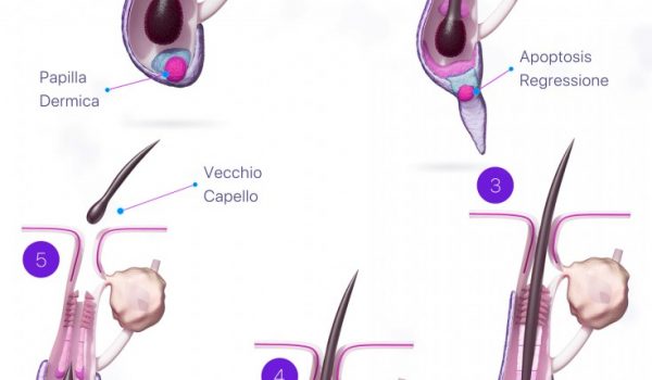 Cinegiornale.net perche-cadono-i-capelli-le-cause-piu-comuni-2-600x350 Perchè cadono i capelli: le cause più comuni News  