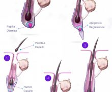 Cinegiornale.net perche-cadono-i-capelli-le-cause-piu-comuni-220x180 Perchè cadono i capelli: le cause più comuni News  